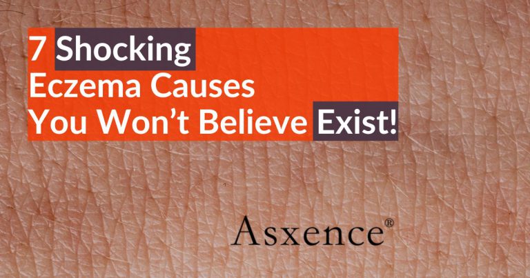 7 Shocking Eczema Causes You Won’t Believe Exist!