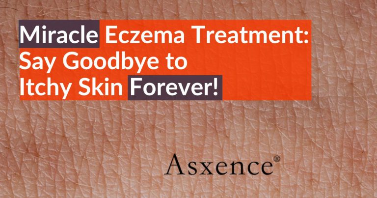 Miracle Eczema Treatment: Say Goodbye to Itchy Skin Forever!
