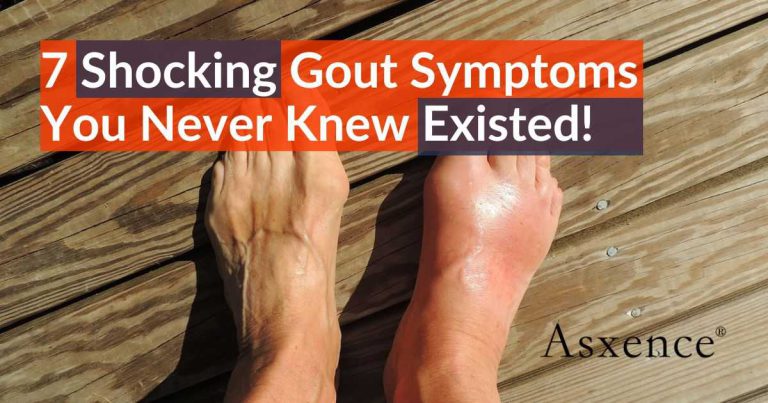 7 Shocking Gout Symptoms You Never Knew Existed!